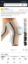 Picture of Knie Bandagen 